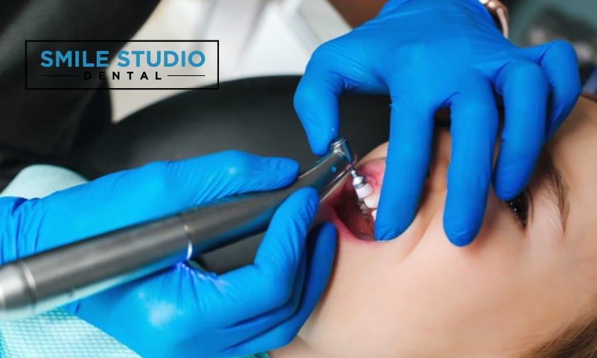 Teeth cleaning treatment by smile studio dental