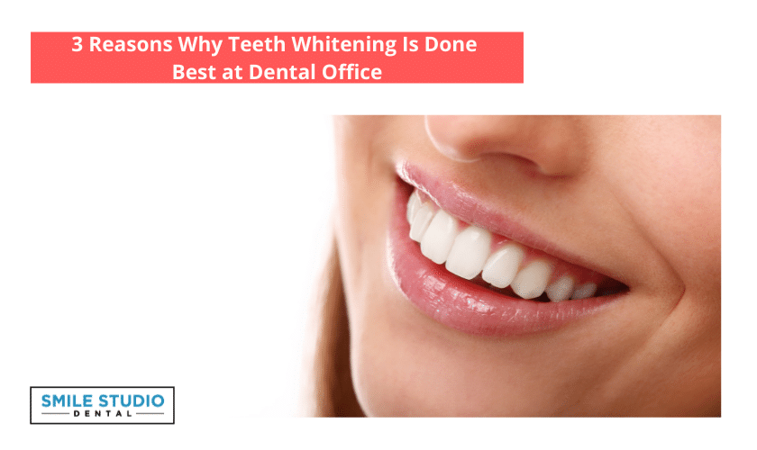 Teeth Whitening service in Denver