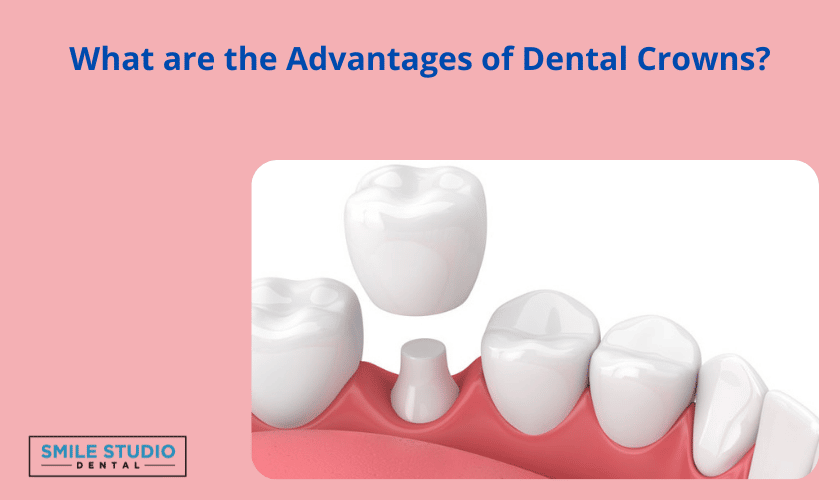 Dental Crowns treatment in Denver