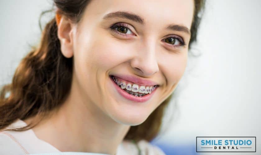 A girl is smiling after done her Buck-Teeth treatment