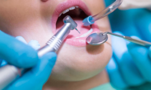 Why Preventative Dentistry Is Better Than Restorative Dentistry