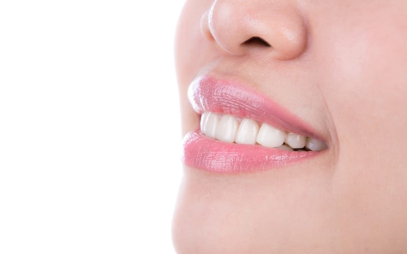 teeth whitening - smile studio dental - denver